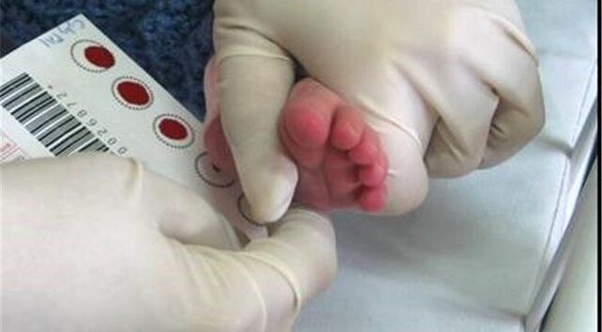 تداوم موفقیت برنامه ملی غربالگری نوزادان با پوشش بیش از ۹۹ درصد