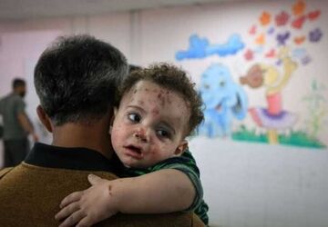 آنروا: جان ۲۰۰ هزار کودک در غزه به دلیل سوءتغذیه در معرض خطر است