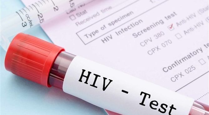 ۹۴ درصد بیماران HIV در ایران با درمان منظم دیگر ناقل ویروس نیستند