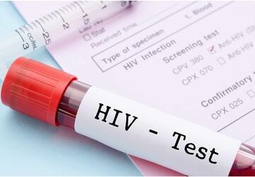 ۹۴ درصد بیماران HIV در ایران با درمان منظم دیگر ناقل ویروس نیستند