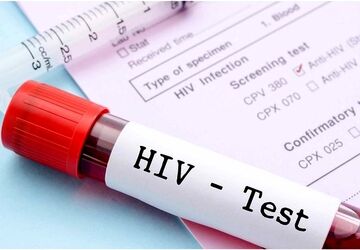 ۹۴ درصد بیماران HIV در ایران با درمان منظم دیگر ناقل ویروس نیستند