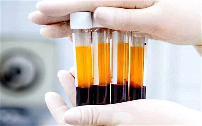  بهبودیافتگان کرونا با اهدای پلاسما به یاری دیگر بیماران بشتابند