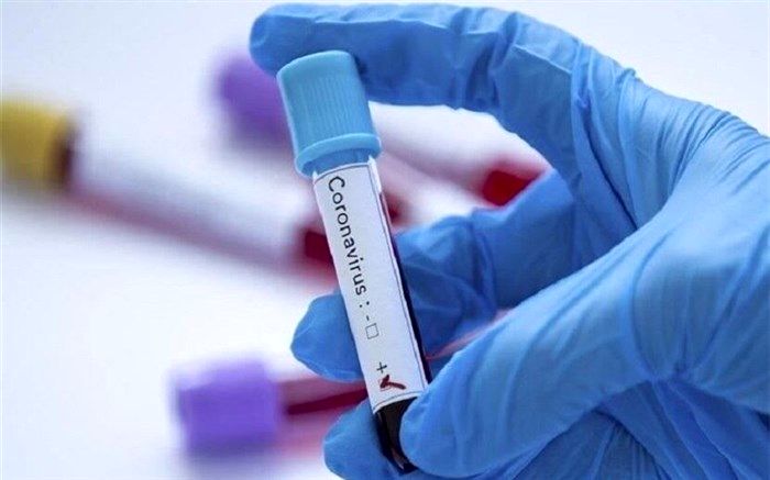 آمار کرونا در جهان تا ۲۲ خرداد+اینفوگرافیک