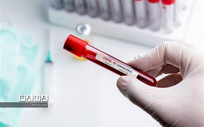 شناسایی ۱۱۶ مورد جدید ابتلا به کرونا طی شبانه روز  گذشته  در خوزستان