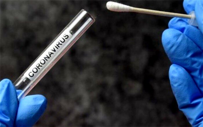 تست PCR قابل‌اعتمادتر است یا نتیجه سی‌تی‌اسکن؟