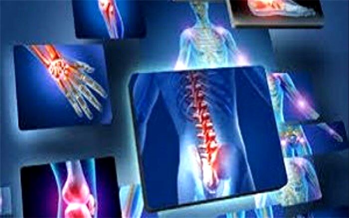 6  خوراکی مفید برای کاهش دردهای مفصلی+اینفوگرافیک