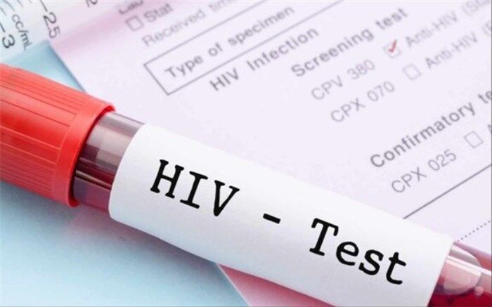 ویروس HIV از مادر به نوزاد منتقل می‌شود؟