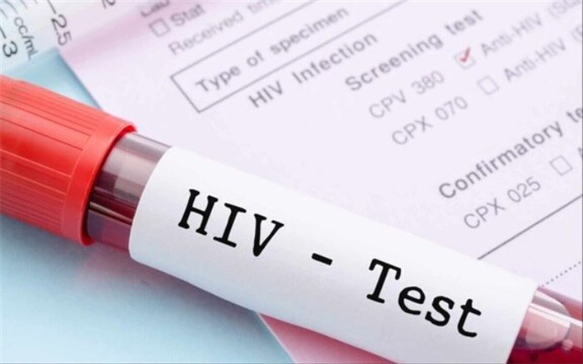 ویروس HIV از مادر به نوزاد منتقل می‌شود؟