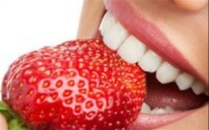 راههایی برای سفید کردن دندان‌ها