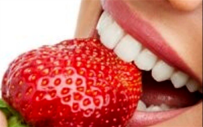راههایی برای سفید کردن دندان‌ها