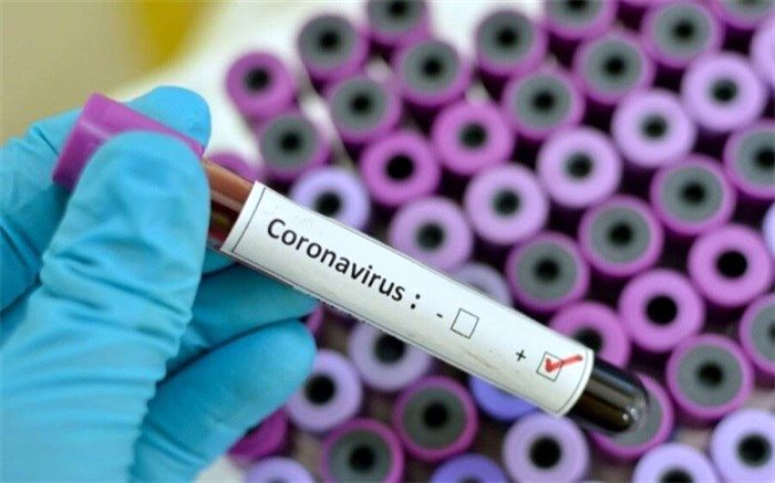 تست کرونا لژیونر ایرانی مثبت شد