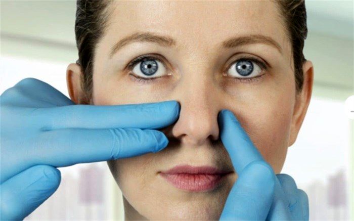 عوارض انحراف بینی