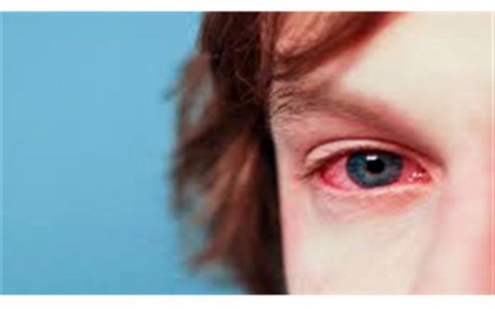 آلرژی فصلی؛ مشکل رایج بهار