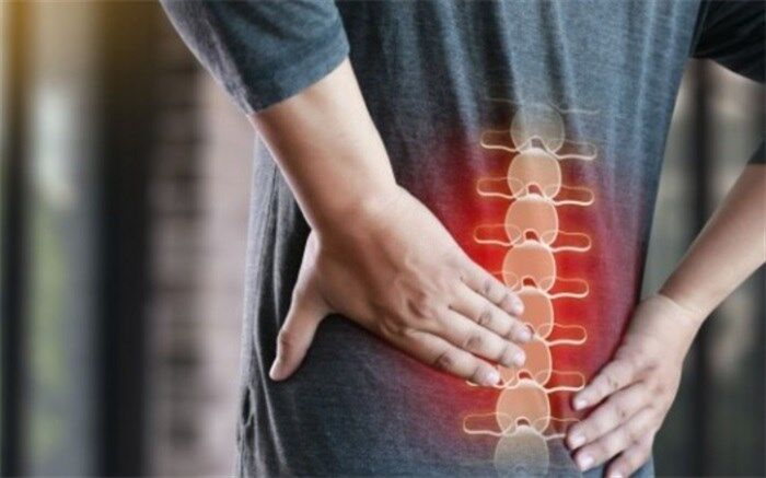راه‌های پیشگیری از گودی بیش از حد کمر