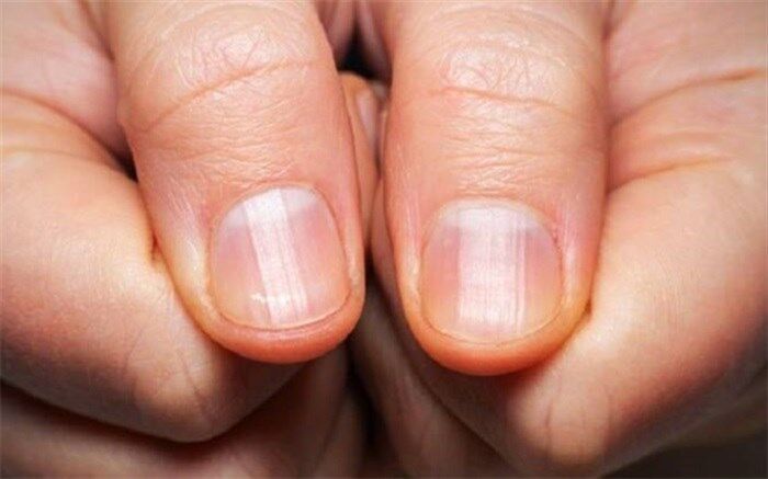 این تغییرات نشانه دیابت است