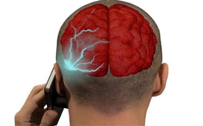 تاثیرات منفی اشعه‌های موبایل بر مغز