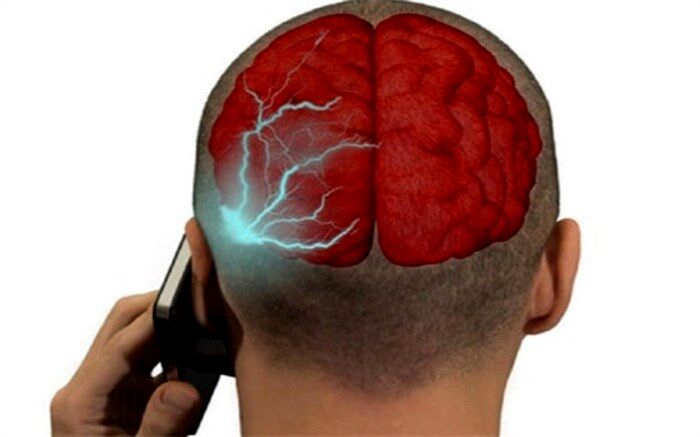 تاثیرات منفی اشعه‌های موبایل بر مغز