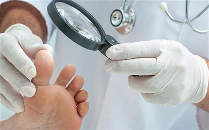 عفونت‌های پوستی شایع در فصل گرما