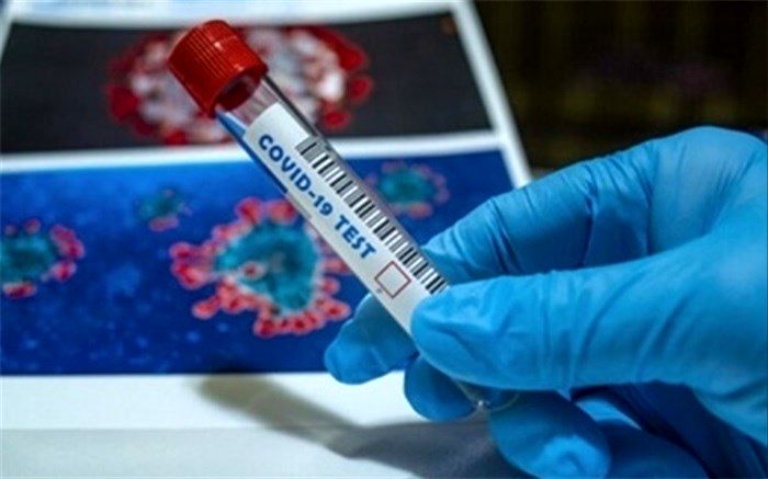 انجام بیش از ۵۸ هزار تست pcr در مرزهای کشور