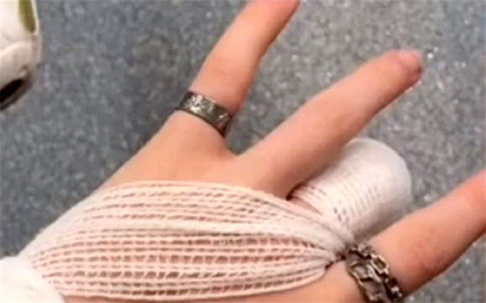 قطع انگشت دختر نوجوان در یک  کنسرت