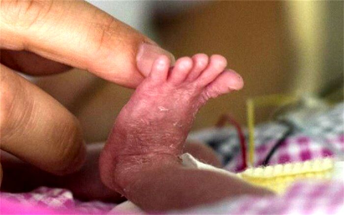 موش،پای کودکی را خورد
