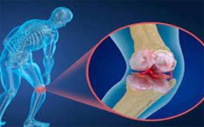 خطر پوکی استخوان با مصرف ۳ ماده غذایی در کمین شماست