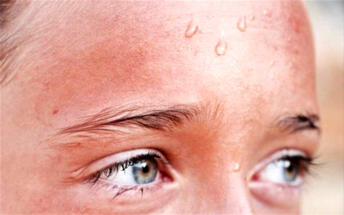 9 دلیل و علت اصلی عرق زیاد بدن