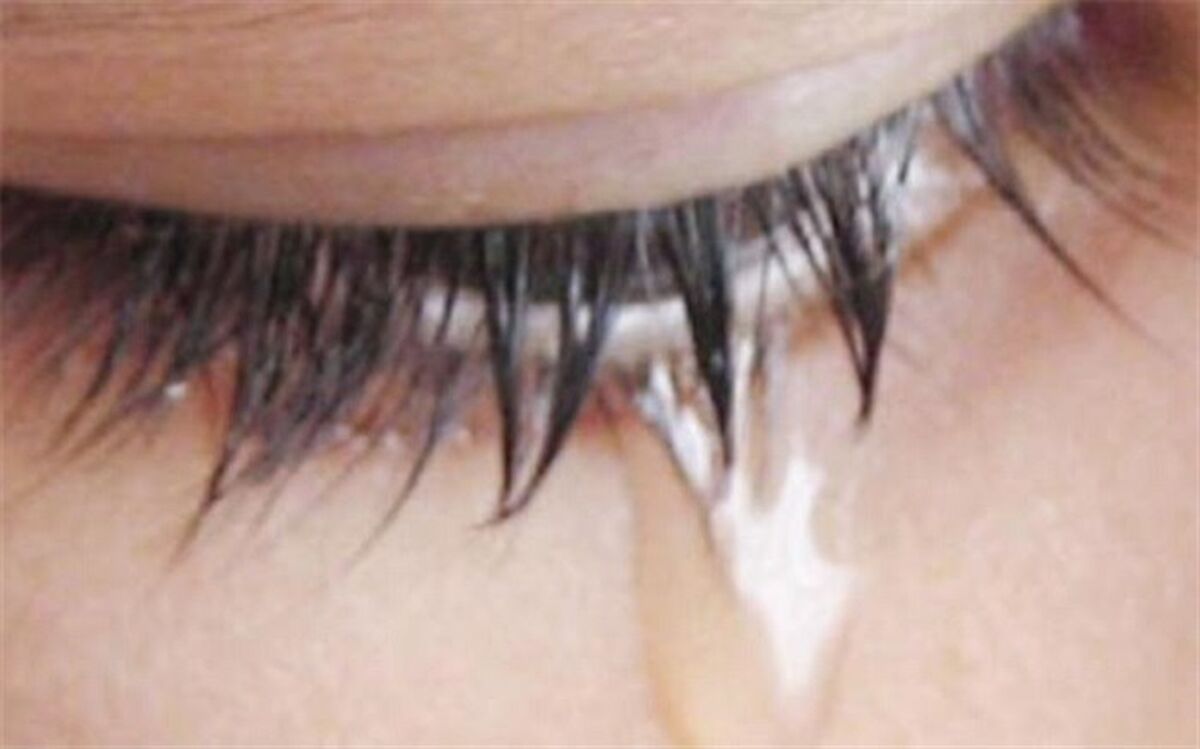 اشک خونین؛ نشانه یک بیماری مرگبار
