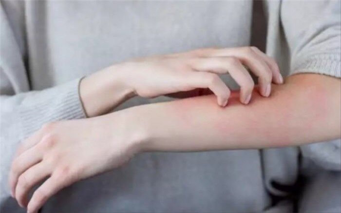 لباس‌های پوست‌آزار