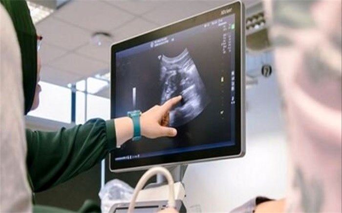4 سونوگرافی‌ ضروری برای مادران باردار کدامند؟