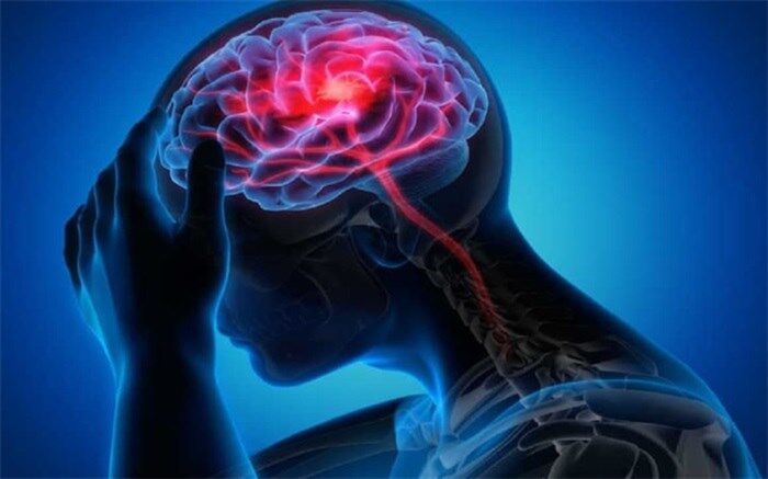 کمبود این ویتامین باعث سکته مغزی می‌شود