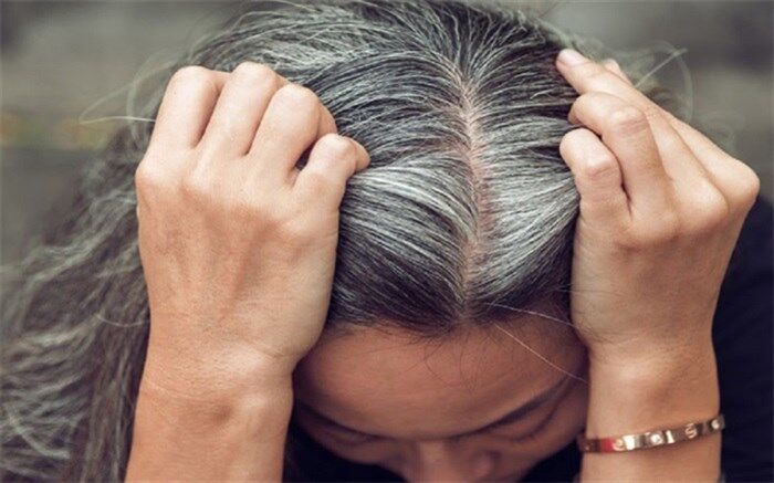 موهایتان به این دلیل سفید می‌شود