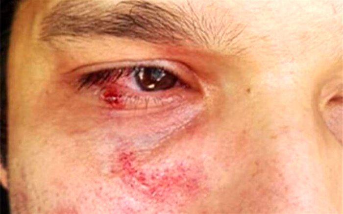 برخورد قانونی و جدی با فرد ضارب پزشک گچسارانی