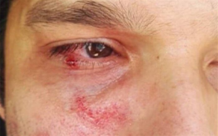 برخورد قانونی و جدی با فرد ضارب پزشک گچسارانی