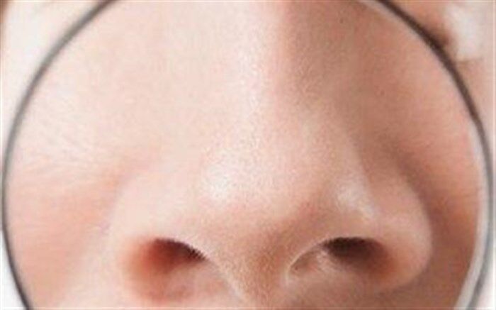 سرد شدن نوک بینی نشانه چیست؟