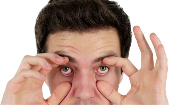 ‌شایع‌ترین علل خشکی چشم در صبح