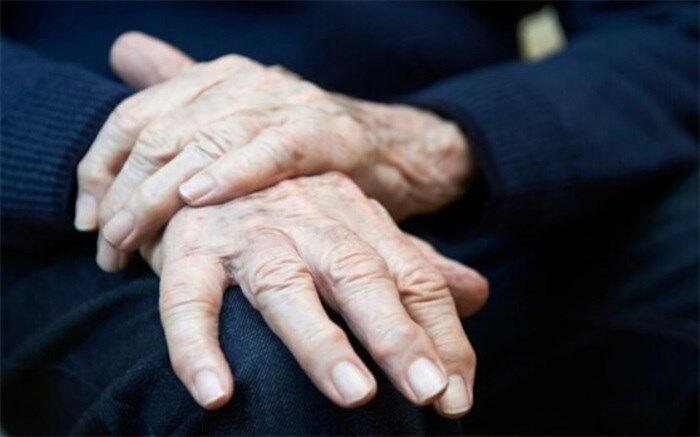 ۴۲۰۰ ایرانی هر سال به خاطر پوکی استخوان فوت می کنند