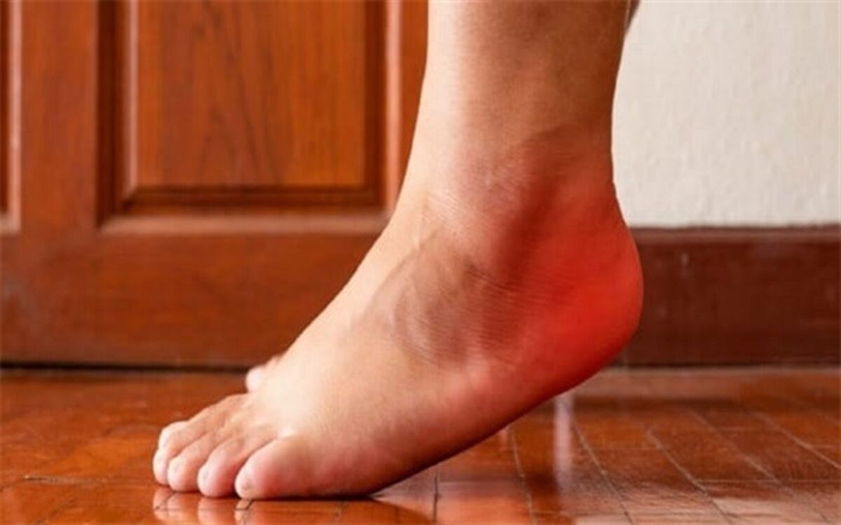 ورم پا به چه دلایلی ایجاد می‌شود؟