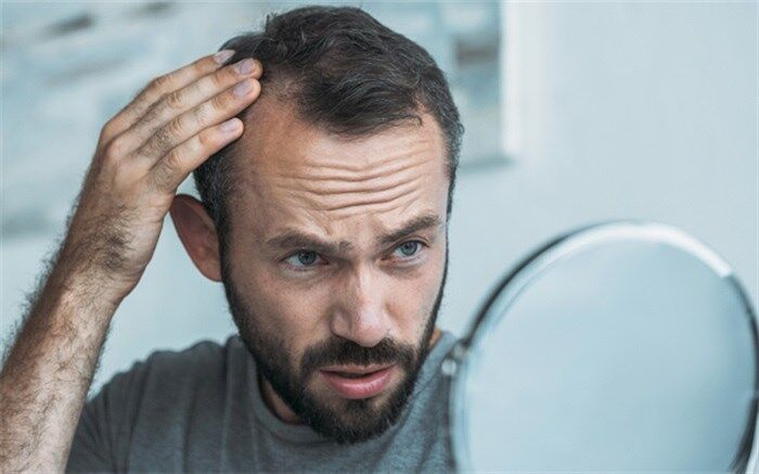 ریزش مو و راهکارهایی برای کنترل آن