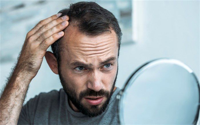 ریزش مو و راهکارهایی برای کنترل آن