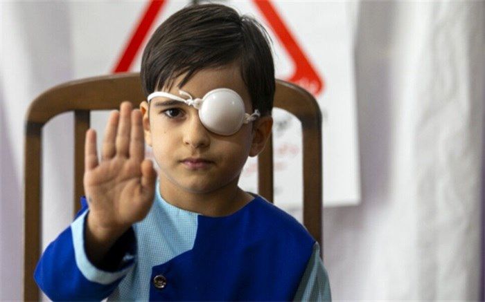 ضرورت توجه جدی به تنبلی چشم کودکان