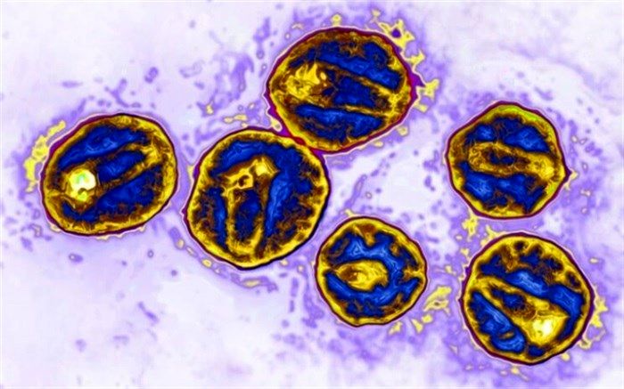 سومین بیمار پس از دریافت سلول‌های مقاوم به «اچ‌آی‌وی» عاری از این ویروس شد