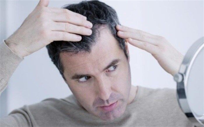 چطور می‌توان جلوی سفید‌شدن موها را گرفت؟