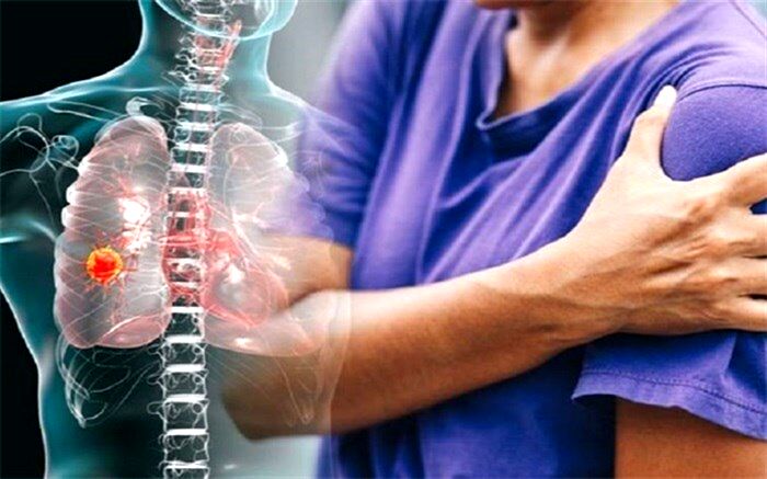 خطر خفگی و تنگی نفس با ترکیب کردن مواد شوینده
