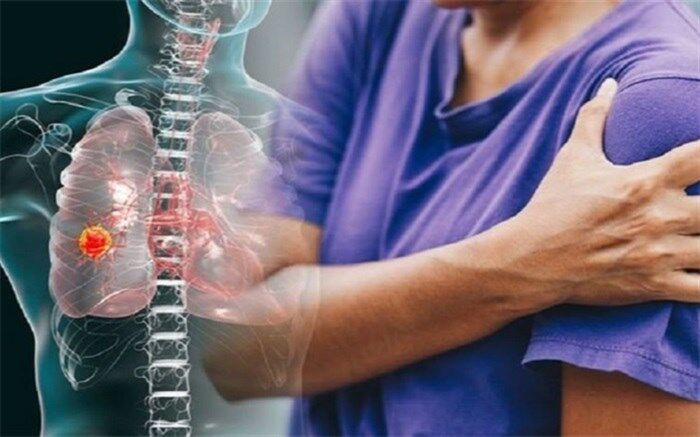 خطر خفگی و تنگی نفس با ترکیب کردن مواد شوینده