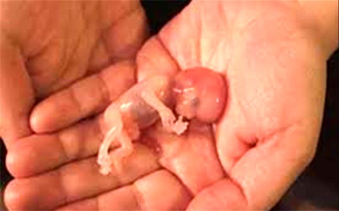 برنامه وزارت بهداشت برای جلوگیری از سقط جنین غیرعمد