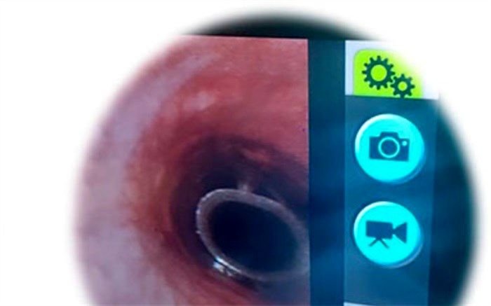 موفقیت پژوهشگران ایرانی در طراحی، ساخت و تست استنت سیلیکونی ریه