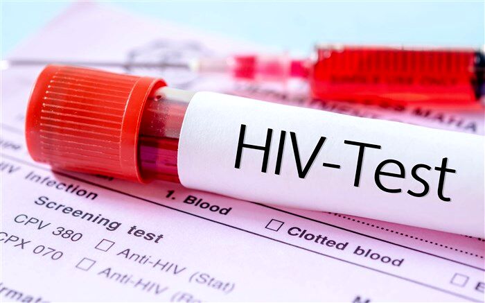 آخرین آمارها از بیماری HIV در کشور