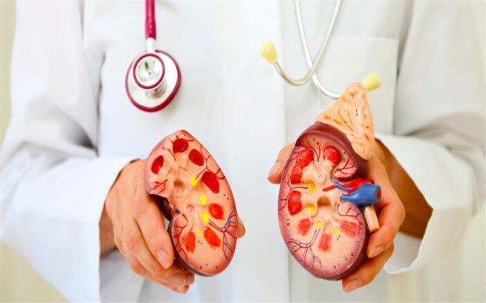 مصرف کم آب یکی از علل اصلی ابتلا به سنگ کلیه