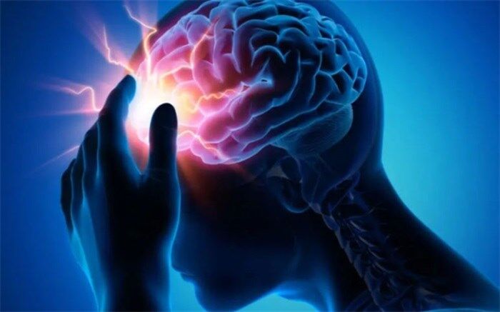 کدام عوامل می‌تواند بروز سکته مغزی را در افراد کاهش دهد؟